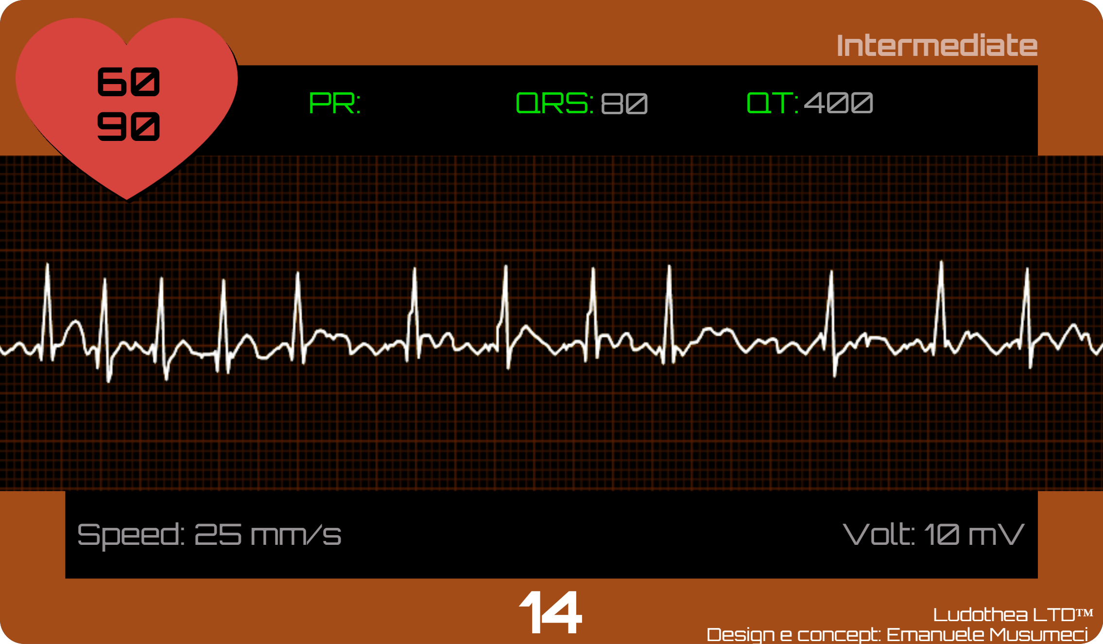 ECG Race intermediate-level atrial fibrillation card